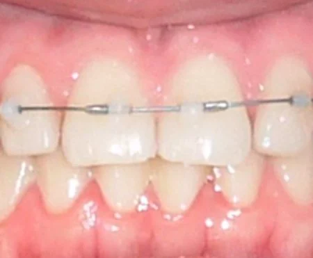 Flow Jac System Testimonios